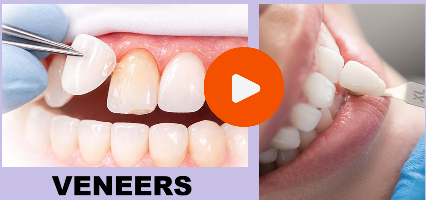 Invisalign and clear aligner treatments in Trivandrum
